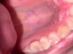 Mouth tour. Uvula and teeth